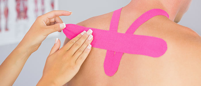 Kinesio taping in rehabilitation - Kennington Osteopaths & Physiotherapy